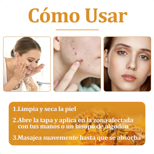 “Veneno de Abejas® – Alivio natural para músculos, articulaciones y tu piel”